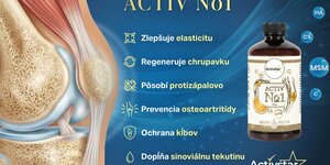 Kĺby nás nosia celý život.